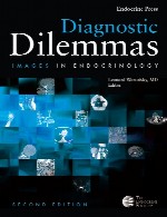 معما های تشخیصی – تصاویر در اندوکرینولوژی – جلد 2Diagnostic Dilemmas: Images In Endocrinology, Volume 2