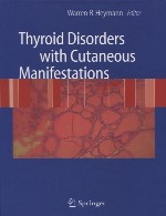 اختلالات تیروئید با تظاهرات جلدیThyroid Disorders with Cutaneous