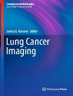 تصویربرداری سرطان ریهLung Cancer Imaging