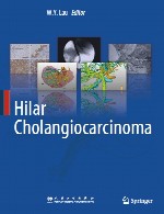کلانژیوکارسینومای ناف ریهHilar Cholangiocarcinoma