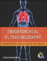 سونوگرافی اندو برونشیEndobronchial Ultrasonography