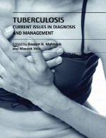 سل (توبرکلوز) – مسائل جاری در تشخیص و مدیریتTuberculosis