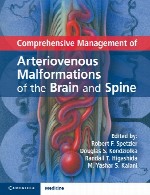مدیریت جامع ناهنجاری های شریانی مغز و ستون فقراتComprehensive Management of Arteriovenous Malformations of the Brain and Spine