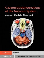 مالفرماسیون های کاورنوس سیستم عصبیCavernous Malformations of the Nervous System