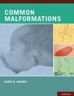 ناهنجاری های رایج (مالفرماسیون ها)Common Malformations