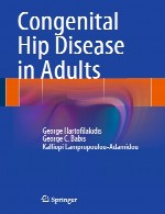 بیماری مادرزادی مفصل ران در بزرگسالانCongenital Hip Disease in Adults