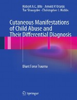 تظاهرات جلدی سوء استفاده از کودکان و تشخیص افتراقی آنهاCutaneous Manifestations of Child Abuse and Their Differential Diagnosis