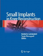 ایمپلنت های کوچک در بازسازی زانوSmall Implants in Knee Reconstruction