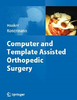 جراحی ارتوپدی به کمک رایانه و الگوComputer and Template Assisted Orthopedic Surgery