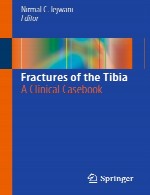 شکستگی های استخوان تیبیا - یک کتاب موردی بالینیFractures of the Tibia - A Clinical Casebook