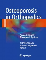 پوکی استخوان در ارتوپدی - ارزیابی و انتخاب های درمانیOsteoporosis in Orthopedics
