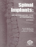 ایمپلنت های ستون فقرات – آیا ما آنها را به درستی ارزیابی می کنیم؟Spinal Implants