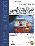 نکته ها و ترفند ها در آرتوپلاستی ران و زانوTips and Tricks in Hip and Knee Arthroplasty