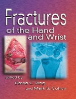 شکستگی های دست و مچFractures of the Hand and Wrist