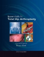 ملزومات در آرتوپلاستی کامل مفصل رانEssentials in Total Hip Arthroplasty