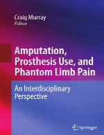 قطع عضو، استفاده از پروتز ، و درد فریبنده اندام - چشم انداز میان رشته ایAmputation, Prosthesis Use, and Phantom Limb Pain