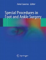 رویه های ویژه در جراحی پا و مچ پاSpecial Procedures in Foot and Ankle Surgery
