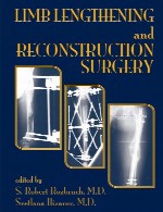 طول سازی اندام و جراحی بازسازیLimb Lengthening and Reconstruction Surgery