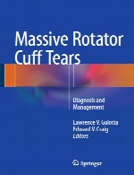 پارگی های بزرگ روتاتور کاف – تشخیص و مدیریتMassive Rotator Cuff Tears
