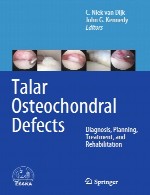 نقص های استوکوندرال (استئو غضروفی) تالار – تشخیص، برنامه ریزی، درمان و توانبخشیTalar Osteochondral Defects