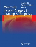 جراحی با حداقل تهاجم در تعویض کامل مفصل ران (آرتوپلاستی توتال هیپ)Minimally Invasive Surgery in Total Hip Arthroplasty