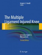 زانوی مصدوم مالتیپل رباط – راهنمای عملی برای مدیریتThe Multiple Ligament Injured Knee
