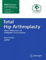 ارتوپلاستی هیپ (تعویض کامل مفصل ران)Total Hip Arthroplasty
