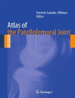 اطلس مفصل پاتلوفمورالAtlas of the Patellofemoral Joint