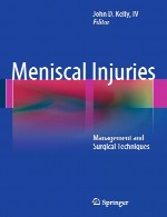 آسیب های منیسک – مدیریت و تکنیک های جراحیMeniscal Injuries