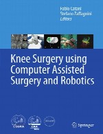 عمل جراحی زانو با استفاده از جراحی به کمک رایانه و رباتیکKnee Surgery using Computer Assisted Surgery and Robotics