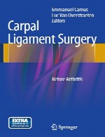 جراحی رباط مچ دست: قبل از آرتریتCarpal Ligament Surgery: Before Arthritis