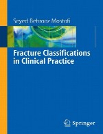 طبقه بندی های شکست در عمل بالینیFracture Classifications in Clinical Practice