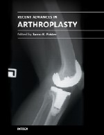پیشرفت های اخیر در آرتروپلاستی (ترمیم مفاصل از طریق جراحی)Recent Advances in Arthroplasty