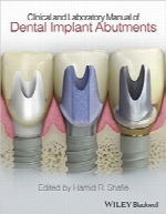 راهنمای بالینی و آزمایشگاهی ایمپلنت اباتمنتClinical and Laboratory Manual of Dental Implant Abutments