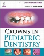 تاج‌های دندان در دندان‌پزشکی کودکانCrowns in Pediatric Dentistry