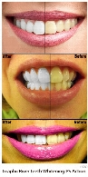 اکشن فتوشاپ سفید کردن دندان ها از گرافیک ریورGraphicRiver Teeth Whitening PS Action Photo Effects
