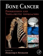 Bone cancer : progression and therapeutic approaches