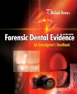 Forensic dental evidence : an investigator's handbook,2nd ed