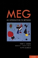 MEG : an introduction to methods
