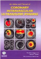 An atlas and manual of coronary intravascular ultrasound imaging