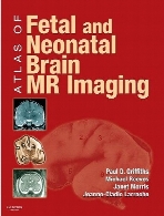 Atlas of fetal and neonatal brain MR