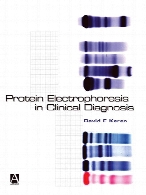 Protein electrophoresis in clinical diagnosis
