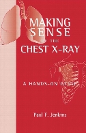Making sense of the chest x-ray : a hands-on guide