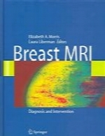 Breast MRI : diagnosis and intervention