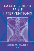 Image-guided spine interventions