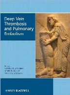 Deep vein thrombosis and pulmonary embolism