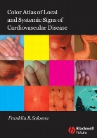 Color Atlas of Local and Systemic Manifestations of Cardiovascular Disease.