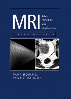 MRI : basic principles and applications