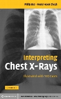 Interpreting chest x-rays : illustrated with 100 cases