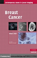 Breast cancer